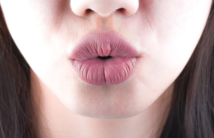 Bulgarian Woman Undergoes 20th Injection In Bid To Get World’s Biggest Lips