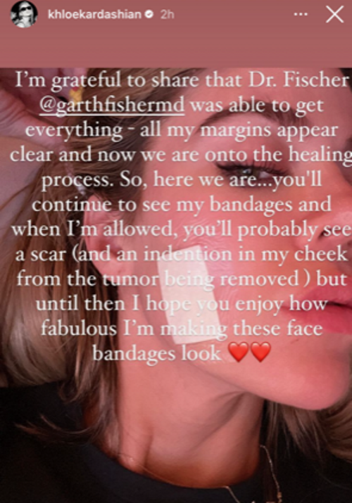 khloe kardashian skin cancer